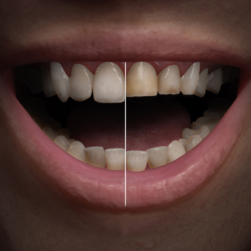 Restorative Dentistry Updates Ebook Library Image