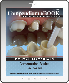 Cementation Basics Ebook Cover