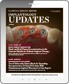 Implantology Updates Ebook Cover