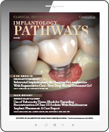 Implantology Pathways Ebook Cover