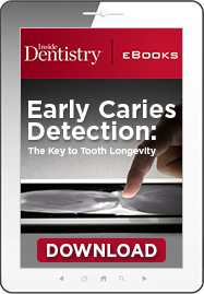 Early Caries Detection: The Key to Tooth Longevity