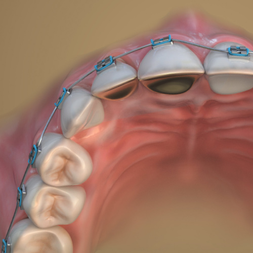 Advances in Orthodontics Ebook Library Image