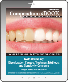 Teeth Whitening: Discoloration Causes, Treatment Methods, and Sensitivity Concerns Ebook Cover