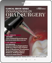 Innovations in Oral Surgery Ebook Cover