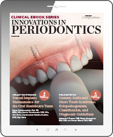 Innovations in Periodontics Ebook Cover