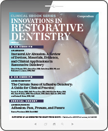 Innovations in Restorative Dentistry Ebook Cover