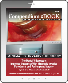 The Dental Videoscope: Improved Outcomes With Minimally Invasive Periodontal and Peri-Implant Surgery Ebook Cover