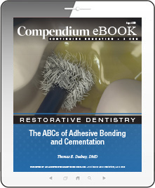 The ABCs of Adhesive Bonding and Cementation Ebook Cover