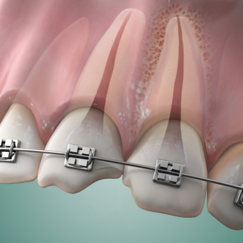 Advancements in Endodontics Ebook Library Image