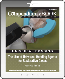 The Use of Universal Bonding Agents for Restorative Cases Ebook Cover