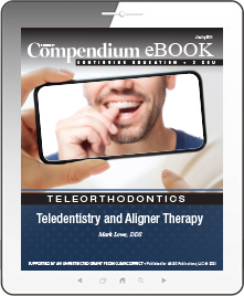 Teledentistry and Aligner Therapy Ebook Cover