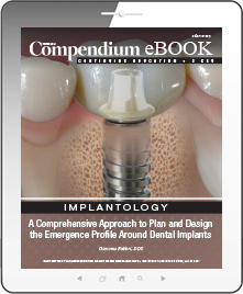 A Comprehensive Approach to Plan and Design the Emergence Profile Around Dental Implants Ebook Cover
