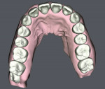 Fig 9. SureSmile simulated model post-treatment, occlusal view.