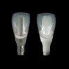 Figure 5  The zenith of the maxillary central incisor should be distal to the middle of the tooth.