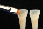 After adjusting the layers with a diamond bur or disk, a brush soaked in modeling liquid is
used to wet the restoration and restore the oxygen inhibition layer.