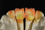 Fig 11. Palatal view.