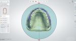 Fig 2. If the middle line is not defined by the dentist, it can be verified by the laboratory. Simply make the lower model less visible and place the occlusal plane in relation to the palatal suture.