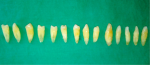 Fig 1. Single-rooted extracted teeth used in this study.
