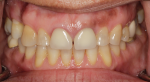Fig 1. Photographs of existing dentition to be used for treatment planning.