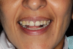 Fig 4. Photographs of existing dentition to be used for treatment planning.