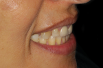 Fig 5. Photographs of existing dentition to be used for treatment planning.