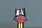 Fig 3. Abutment to be anodized, with wax block-out of selected area.