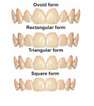 Fig 15. Four forms of teeth templates for virtual smile designing.