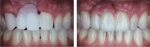 Fig 29. Retracted intraoral macro photography documents various treatment phases.