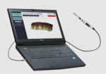 Fig 2. Intraoral scanner used to make the digital impressions of the teeth.