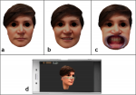 Fig 1. 3D face scans in three positions: (a) relaxed neutral position, (b) smile position, (c) retracted cheeks. (d) Image of the mobile phone used for the facial scan.