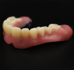 Fig 19. The final denture after milling from a monolithic block and assembly.