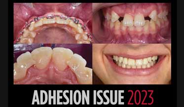 Adhesion Issue 2023