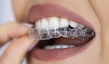More Than Straightening Teeth: The Orthodontist’s Role in Sleep Dentistry