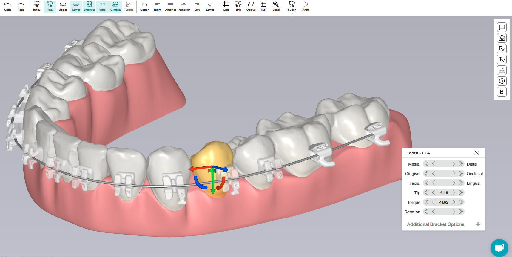 LightForce Orthodontics Secures 80 Million Series D Funding Led By