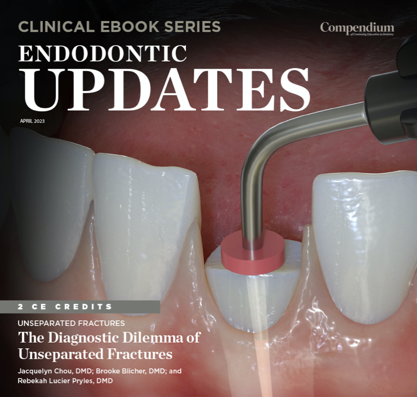 Endodontic Updates