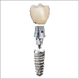 Hahn Implants from Glidewell: Renowned Quality, Affordably Priced