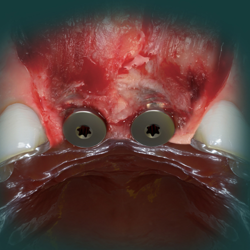 Oral Surgery Updates Ebook Library Image