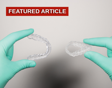 3D Printing of Thermoflexible Therapeutic Splints: Treating Bruxism More Comfortably