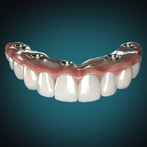 Prosthodontic Solutions Ebook Library Image