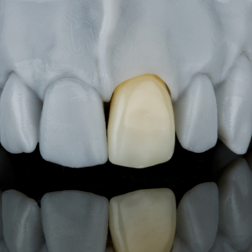 Advantages of Monolithic Zirconia Restorations With CEREC Ebook Library Image