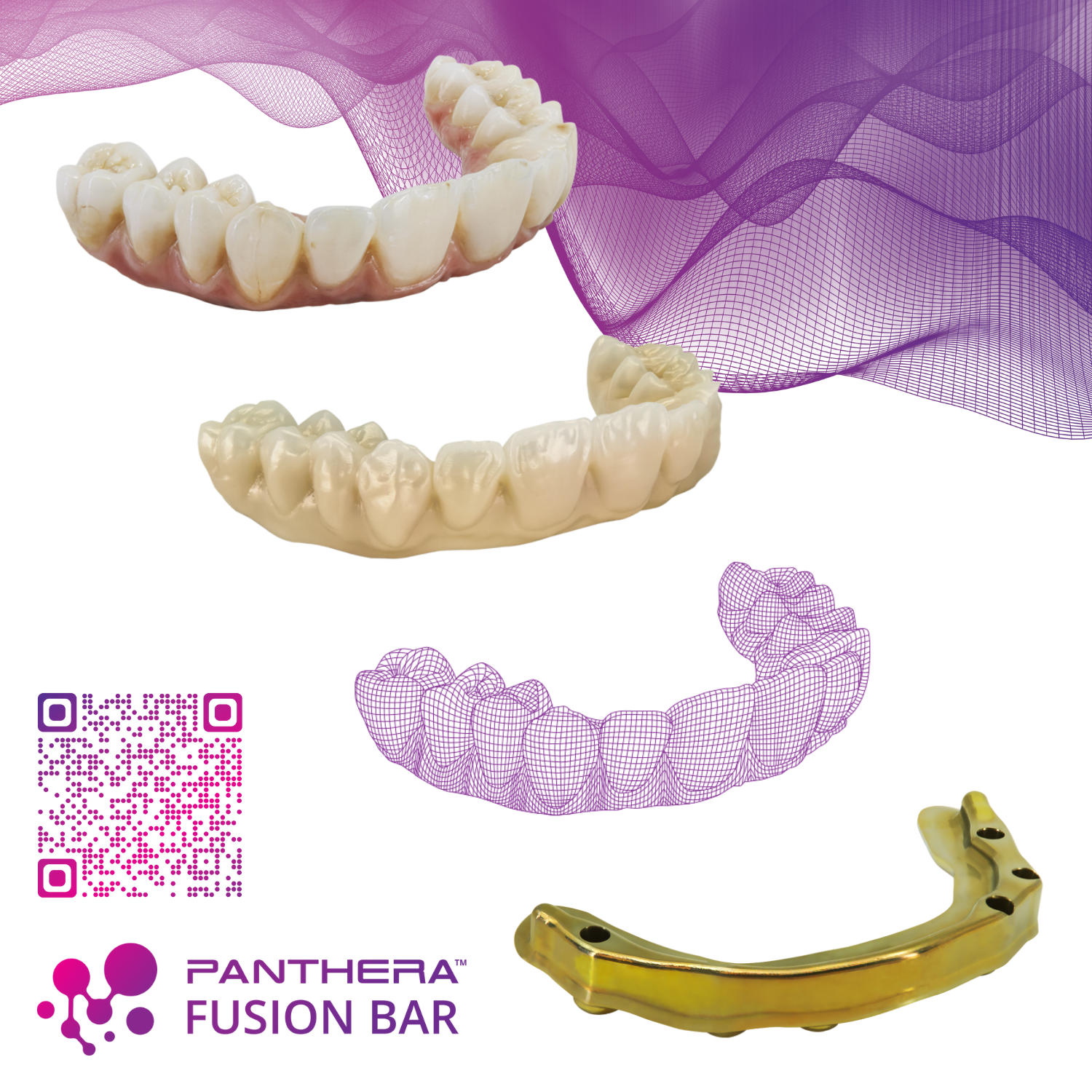 Time, Energy, and Money Saver The Panthera Fusion Bar™ redefines the dental restoration process