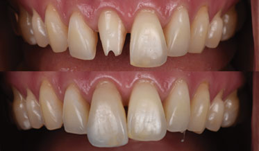 Bonding Through Collaboration