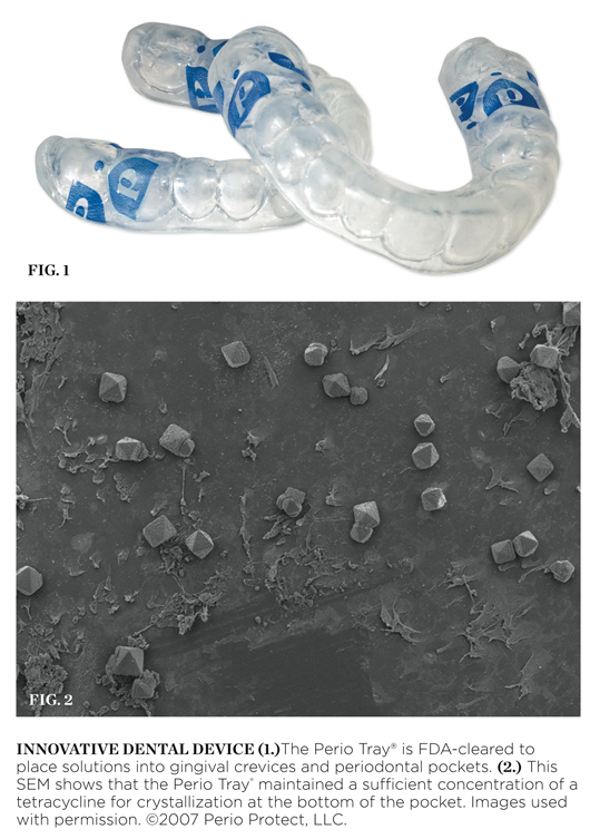 Perio Tray® Perio Protect, LLC March 2010 Inside Dentistry