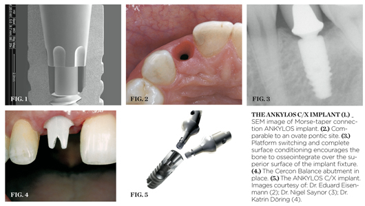 Technology | Dental Implant Centre @ Twyford Dental