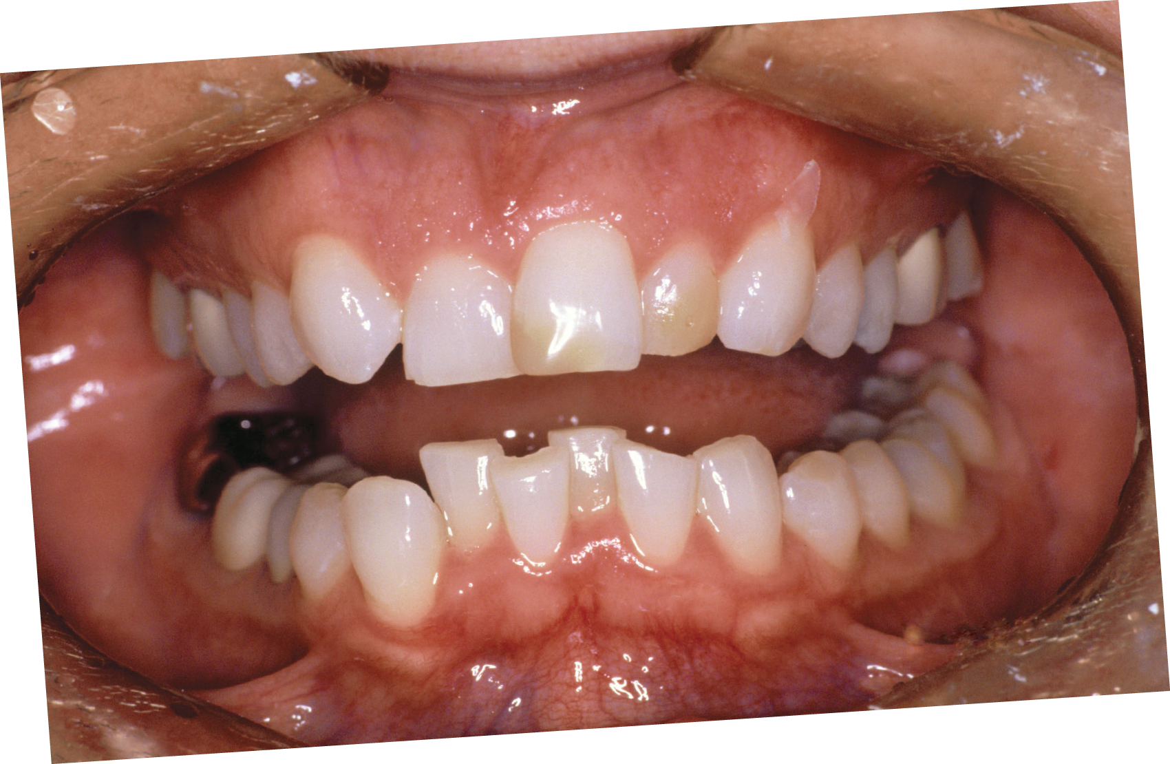 Oral Exam July 2013 Inside Dentistry