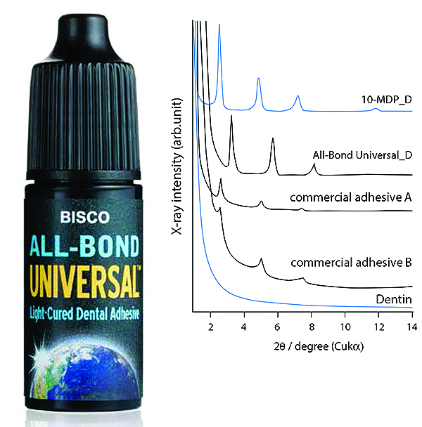 BISCO’s AllBond Universal From TotalEtch to SelfEtch to “Universal