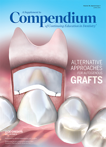 Compendium-Supplement-Geistlich June 2014 Cover