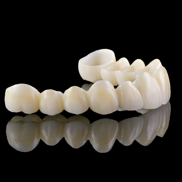 Innovations in Ceramics May 2015 Inside Dentistry