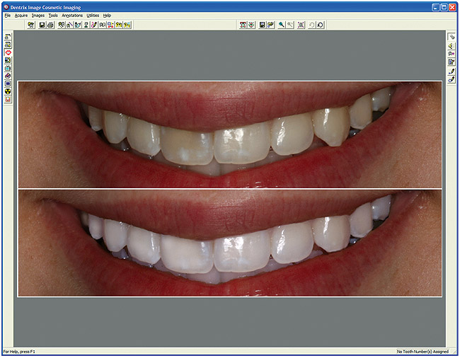 Focus On Cosmetic Dental Simulation Technology Creating Integrated