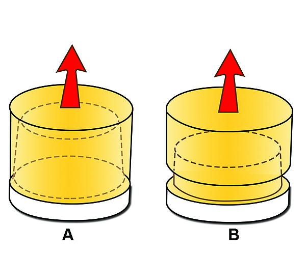 Tooth Preparation Theory Application to Custom Abutment Design July